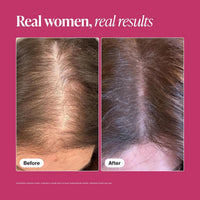 Viviscal Suplementos para el crecimiento del cabello para mujeres, soporte para el cabello más grueso y completo para adelgazar el cabello y la pérdida de cabello, con biotina y colágeno marino, sin