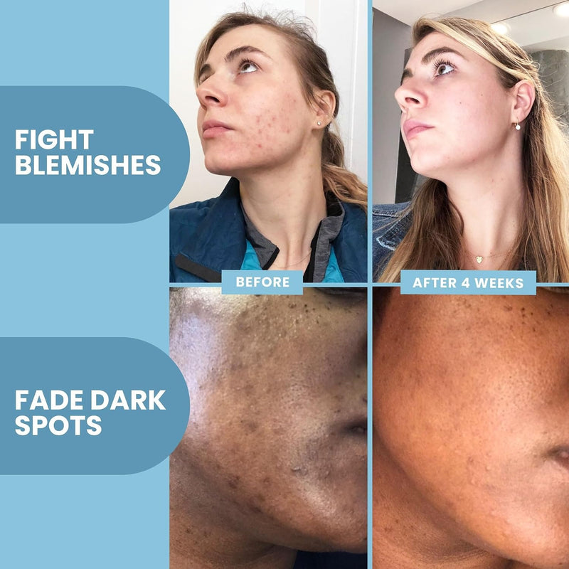 Eva Naturals Suero de vitamina C Plus, 2 % retinol, 3,5 % niacinamida, 5 % ácido hialurónico, 2 % ácido salicílico, 10 % MSM, 20 % vitamina C, suero para limpieza de piel, reparador de piel antienveje