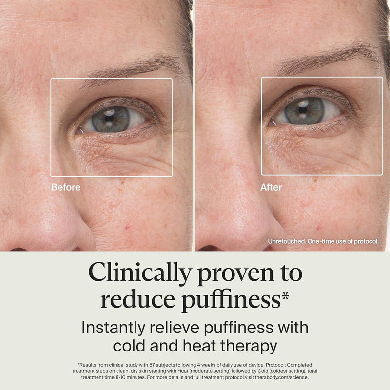 Therabody TheraFace - Varita desinfladora - Tratamiento para el cuidado del frío y el calor de la piel para deshinchar y brillar; varita de belleza, rodillo facial y masajeador de ojos para hinchazón