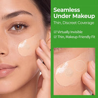 Dr.Melaxin S-ZINC ZERO-FIT Ultra Thin Blemish Spot Patch 0.013mm Invisible Pimple Stickers with Sulfur, Salicylic Acid, AHA & PHA, Seamless Under Makeup Face Cover, 12mm x 72 Patches