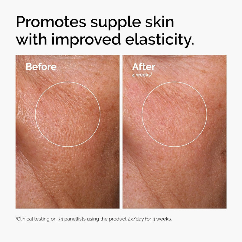El conjunto de sueros favoritos de The Ordinary – Ácido hialurónico 2% + B5, niacinamida 10% + zinc 1%, solución de cafeína 5% – Sueros para ojos y cara para hidratar, iluminar y minimizar los poros