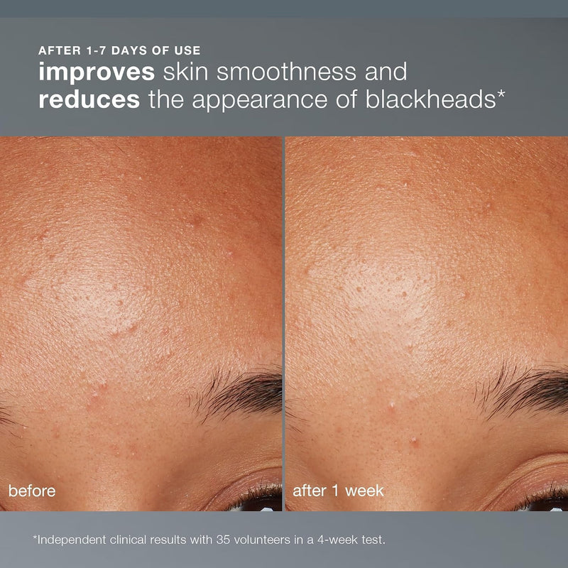 Dermalogica Daily Microfoliant, Exfoliating Face Wash for Brightening