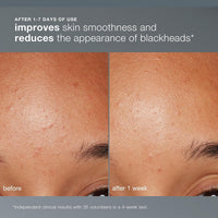 Dermalogica Daily Microfoliant, Exfoliating Face Wash for Brightening