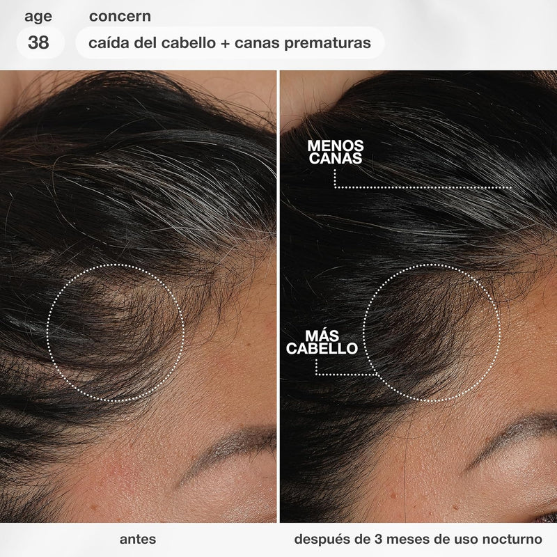 K18 FutureIQ Biomimetic Longevity Hair + Scalp Serum, 3.04 oz