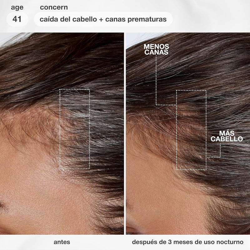 K18 FutureIQ Biomimetic Longevity Hair + Scalp Serum, 3.04 oz