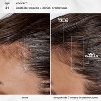 K18 FutureIQ Biomimetic Longevity Hair + Scalp Serum, 3.04 oz