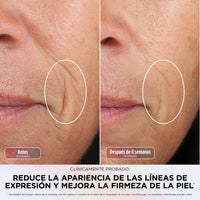 Mascarilla facial LED Shark CryoGlow con enfriamiento ocular, antienvejecimiento y reparación de imperfecciones, USB-C y control remoto