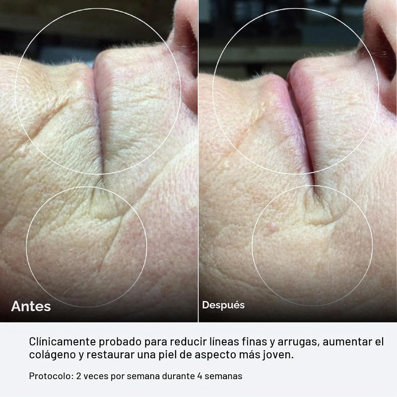 Celluma PRO Series 1 - Terapia de Luz LED Profesional (Antienvejecimiento, Acné y Alivio del Dolor)