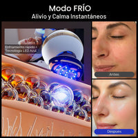 Dispositivo facial microcorriente 8 en 1 INIA SPHERA con luz roja, tratamiento térmico y modos personalizados para cuidado en casa