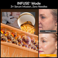 Dispositivo facial microcorriente 8 en 1 INIA SPHERA con luz roja, tratamiento térmico y modos personalizados para cuidado en casa