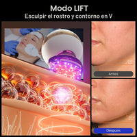 Dispositivo facial microcorriente 8 en 1 INIA SPHERA con luz roja, tratamiento térmico y modos personalizados para cuidado en casa