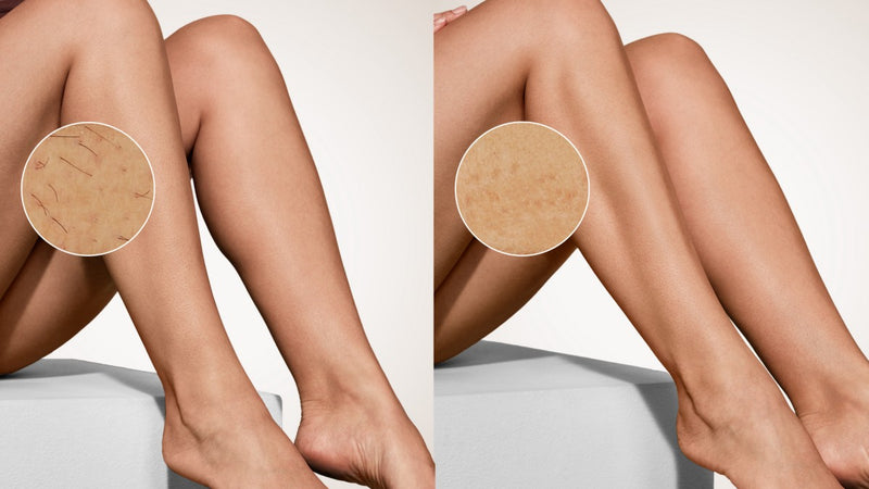 Philips Lumea IPL 9900 Pro - Depiladora IPL con SenseIQ Pro (BRC332/03)