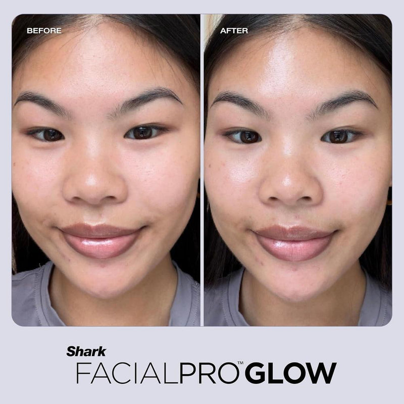 Shark FacialPro Glow Sistema facial en casa con tecnología avanzada y terapia DePuffi para limpieza e hidratación de la piel