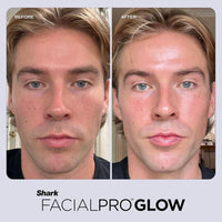 Shark FacialPro Glow Sistema facial en casa con tecnología avanzada y terapia DePuffi para limpieza e hidratación de la piel