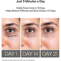 Dispositivo 4 en 1 de belleza con terapia de luz roja, calor, masaje y vibración para ojeras, hinchazón y reafirmar la piel