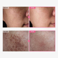 Tosowoong Crema Arbutin 7% + Ácido Tranexámico 4% 50ml