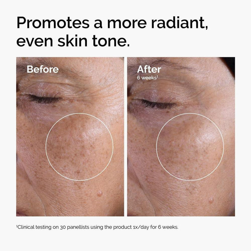 The Ordinary Tónico Exfoliante De Ácido Glicólico 7%, Mejora Luminosidad E Ilumina La Piel