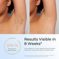 Depiladora IPL para Mujeres y Hombres con Tecnología de Luz Roja 3.0, Uso Facial, Corporal y Zonas Sensibles en Casa