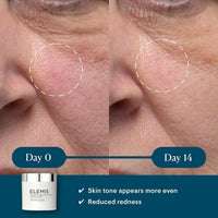 ELEMIS Almohadillas Faciales de Renovación Dinámica, Exfoliantes de Textura Suave para Tratamiento Facial