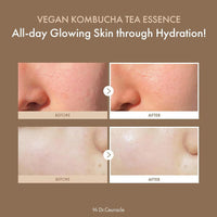 Dr.Ceuracle Esencia Vegana De Té Kombucha Hidratante Con Ceramida 150ml