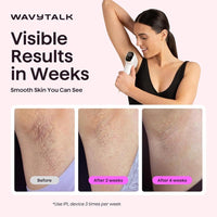 Wavytalk Depiladora IPL con Doble Pulso y Enfriamiento, Uso en Casa, Duradera e Indolora, Para Bikini, Cara y Cuerpo