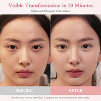 Parches Para Ojos GrlGrl PDRN 5000ppm 60 Unidades