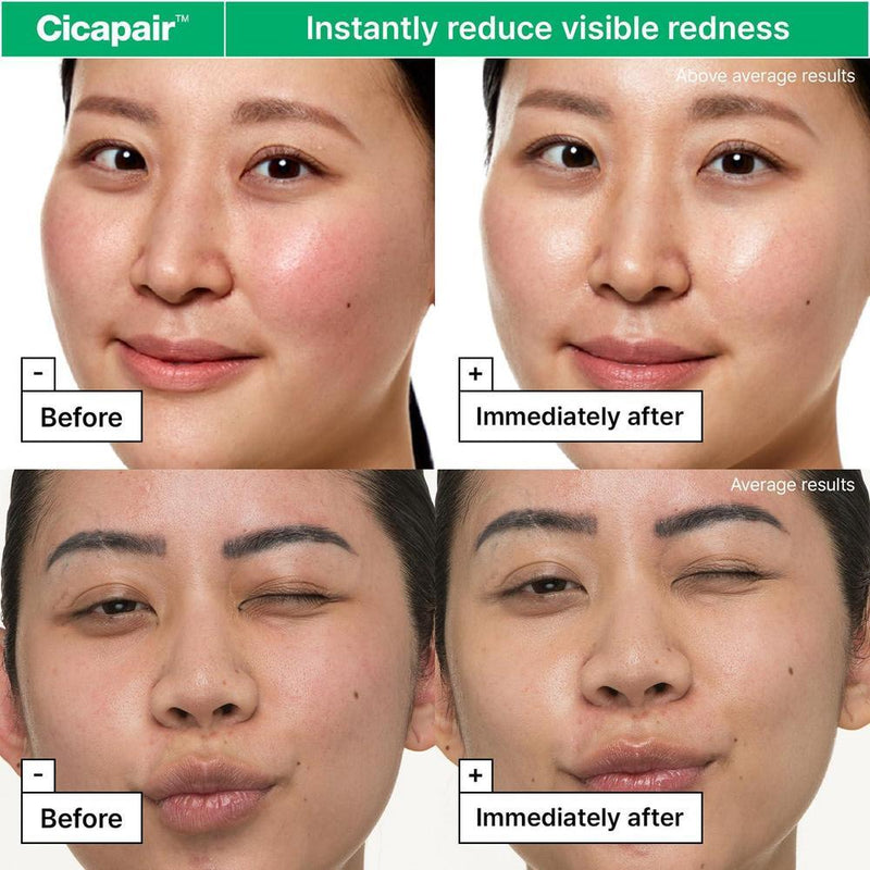 Hidratante Facial Dr.Jart+ Cicapair Para Piel Sensible Con Centella Asiática