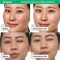Hidratante Facial Dr.Jart+ Cicapair Para Piel Sensible Con Centella Asiática