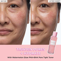 Watermelon Glow Tónico PHA+BHA Reductor de Poros