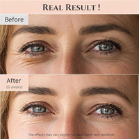 Beauty Of Joseon Retinol Niacinamide Eye Serum 30ml