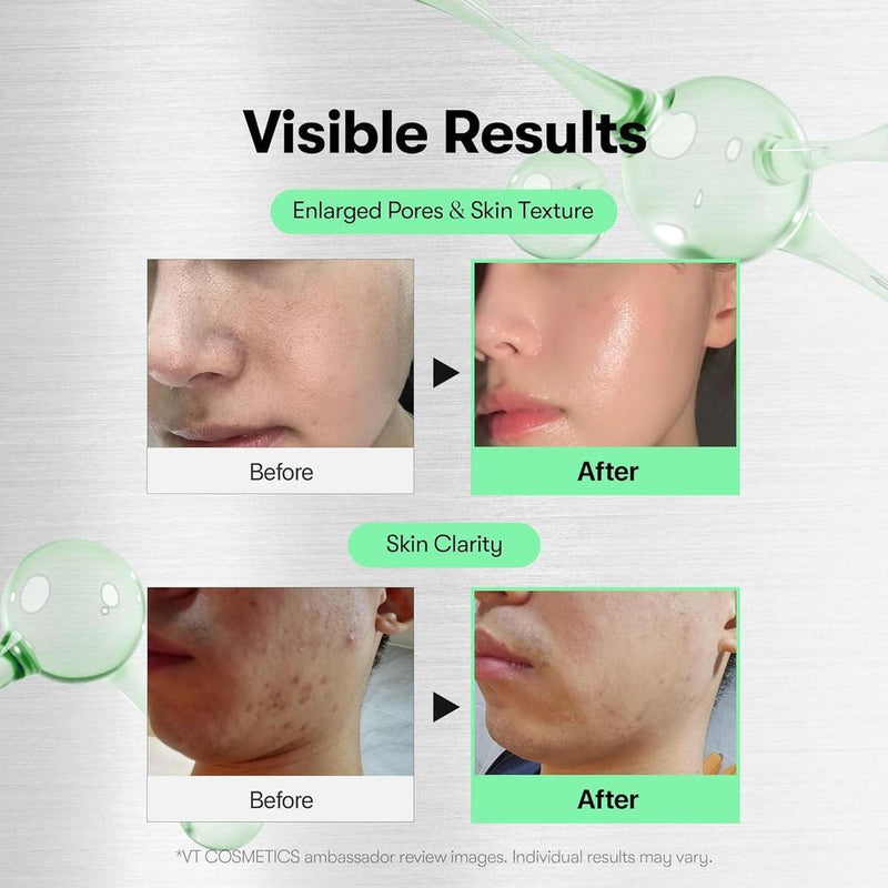 Vt Cosmetics Suero Microneedling Cica Reedle Shot 100 Exfoliación Poros 50ml