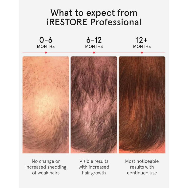 Sistema de terapia láser iRestore para el crecimiento del cabello, autorizado por FDA para calvicie y alopecia