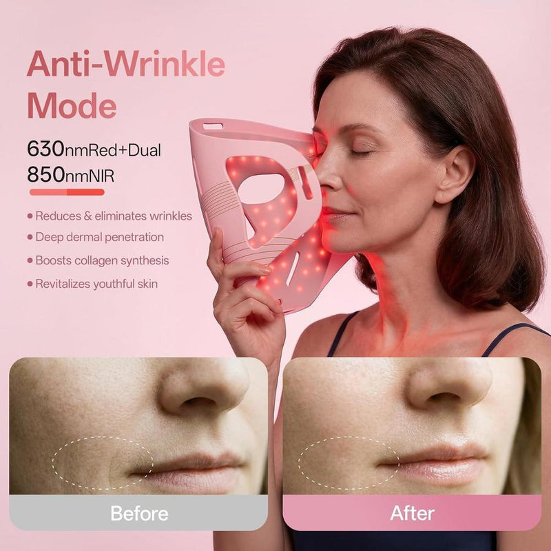 Terapia de luz roja profesional para cara y mandíbula, mascarilla LED 4D inalámbrica con 324 LEDs