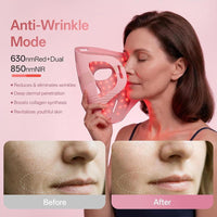 Terapia de luz roja profesional para cara y mandíbula, mascarilla LED 4D inalámbrica con 324 LEDs