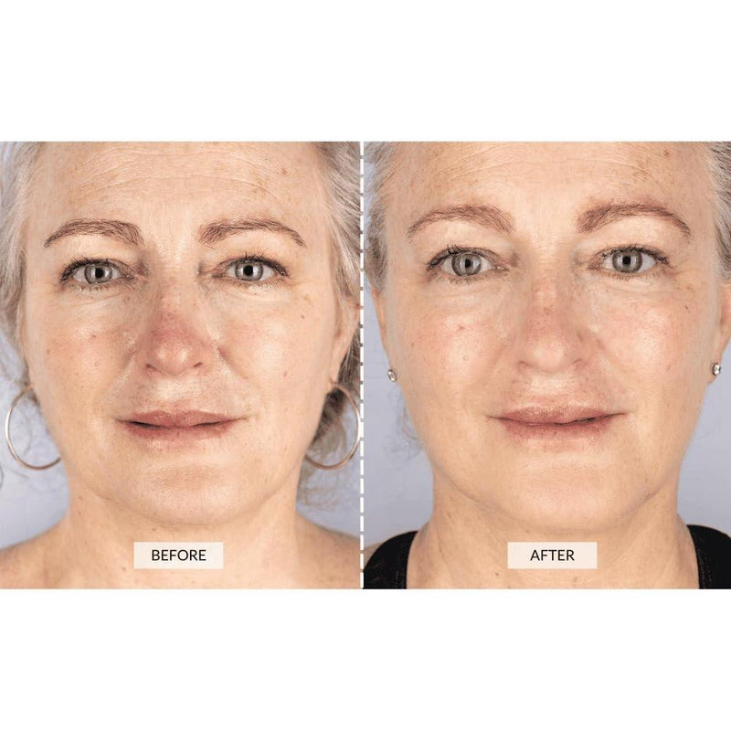 Máscara Facial de Terapia LED CurrentBody para Reducción de Arrugas y Rejuvenecimiento de Piel