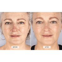 Máscara Facial de Terapia LED CurrentBody para Reducción de Arrugas y Rejuvenecimiento de Piel