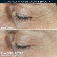 Roc Crema Para Ojos Retinol 20ml