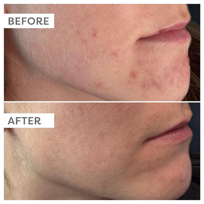 Suero Facial TruSkin Vitamina C Ácido Hialurónico Vitamina E 30ml