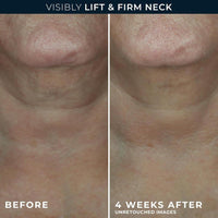 Roc Derm Correxion Crema Para El Cuello Con Ácido Hialurónico Y Retinol Avanzado 50g