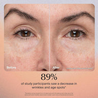 Dispositivo facial Therabody TheraFace PRO con microcorriente, masaje y terapia de luz para cuidado de la piel