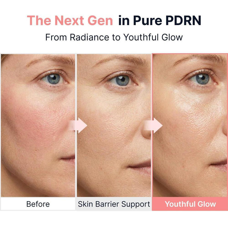 Ampolla intensiva Glow PDRN con péptidos de cobre y vitamina B12, colágeno y ácido hialurónico para el cuidado facial coreano