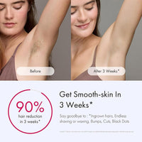 Ulike Depiladora IPL con Enfriamiento de Hielo y 3 Modos, para Resultados Indoloros y Duraderos, Rápida para Todo el Cuerpo