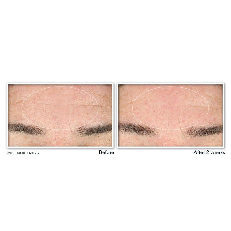 RoC Derm Correxion Serum Limpiador Facial Niacinamida 6oz