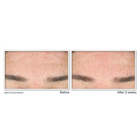RoC Derm Correxion Serum Limpiador Facial Niacinamida 6oz