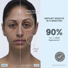 NuFACE MINI+ Kit De Dispositivo Facial De Microcorriente Para Esculpir, Levantar Y Tonificar La Piel, Aprobado Por La FDA