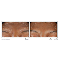 RoC Derm Correxion Serum Limpiador Facial Niacinamida 6oz