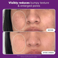 Paula's Choice Serum Niacinamida 20% 19.82ml