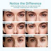 Máscara de ojos de luz roja infrarroja para ojeras, arrugas y bolsas. Dispositivo antienvejecimiento con 3 minutos por sesión