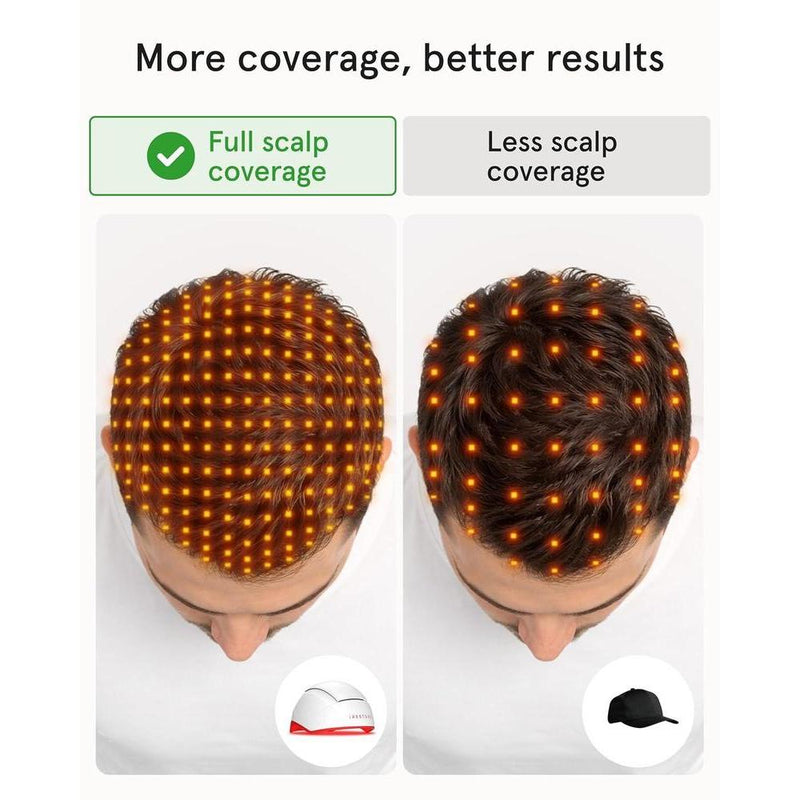 Sistema de terapia láser iRestore para el crecimiento del cabello, autorizado por FDA para calvicie y alopecia