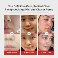 Medicube Age-R Booster Pro 6-en-1 Masajeador de Belleza para Piel Radiante y Firme con Tecnología Coreana